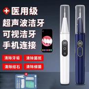 洁牙器超声波牙结石医用电动洁牙器家用去除牙垢可视洁牙hq