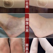 李佳琪 屁屁变白大腿内侧去黑 关节去黑色素全身.可用pp