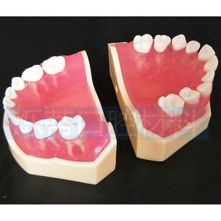 牙科模型1120颗标准儿童教学牙模型全口牙可拔下齿科材料牙模