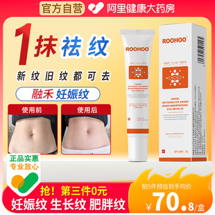 roohoo修纹膏产后祛妊娠纹消除霜去除肥胖修复淡化药膏