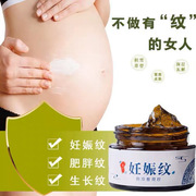 妊娠纹产后修复霜孕妇专用预防紧致肚皮肥胖纹生长纹橄榄油
