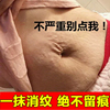 妊辰纹消除去妊娠纹紧致肚皮淡化肥胖纹修复霜产后消除疤痕除疤膏