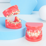 牙齿模型口腔教学摆件口腔医患沟通练习正畸托槽可拆卸全口牙模