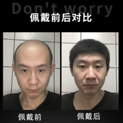 假发男短发头顶补发块真发男士真人发头套男生头发整顶人发套