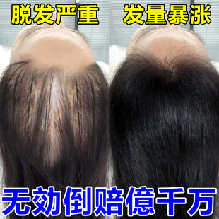 青束头发增长液快速短发变长发际线加快生长增密浓密精油护发男女