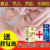 去痣点痣膏无痕非药水脸部，祛斑淡斑神器，点斑水祛痣笔专用膏液
