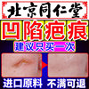 凹陷性疤痕修复点痣脸上伤疤去除疤膏水痘坑生长因子祛疤DD