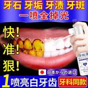 祛除牙粉速效黄污垢牙菌斑美白牙结石牙斑净洗去牙齿烟渍清洁神%