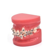 牙科模型正畸陶瓷托槽模型矫正种植医患沟通教学模型牙科材料