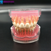 牙科模型口腔科教学模型，练习拔牙模型拆卸牙齿软牙龈全口可拔