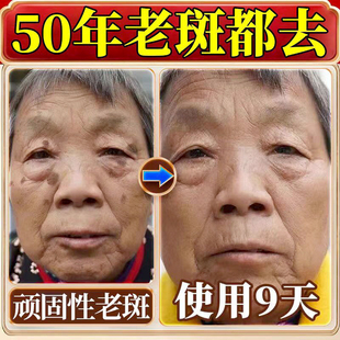 同仁堂祛斑霜祛黄褐斑老年斑强力去除手部脸部专用