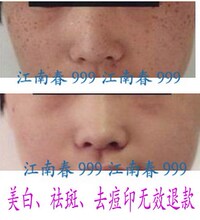 100%好评美白凝葆丽柔润雪颜美白保湿组合护肤淡斑去皱亮泽嫩滑
