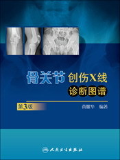 正版★骨關節創傷X線診斷圖譜 (第3版)在類目 書籍/雜誌/報紙, 醫學衛生, 特種醫學中 - 來自Buy2taobao.com提供專業的淘寶代購服務