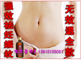 皇冠百分百好评店 祛妊娠纹精油 去妊娠纹 淡黑色素 无效退款