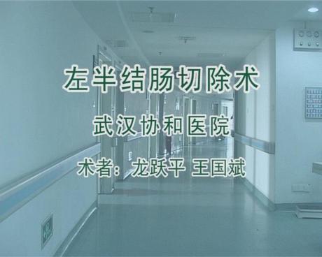 武汉协和医院龙跃平教授左半结肠切除术 高清