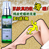 【卿颜阁】毛周角化修复液升级版 去鸡皮疙瘩/鸡皮肤 毛周角化症