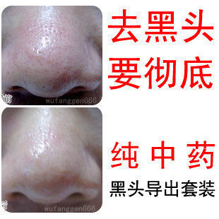 店主自用:去黑头面膜+收毛孔产品/粉刺祛黑头导出液正品鼻膜鼻贴
