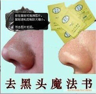 超强神奇去黑头中华百草纯中药鼻膜/鼻贴中药调理只需1元