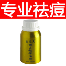 黛依美祛痘精华 中药祛痘印祛痘疤 去痘印 痘疤 凹洞 痤疮 青春痘