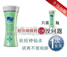 包邮 正品巴黎雪完美去痘无印爽肤水180ML 祛痘淡痕印化妆水