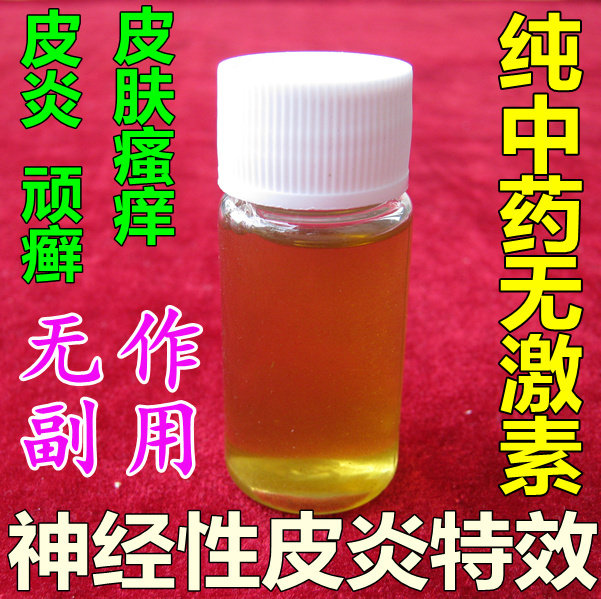 神经性皮炎 脂溢性皮炎 牛皮癣 股癣 偏方特效 香香偏方药