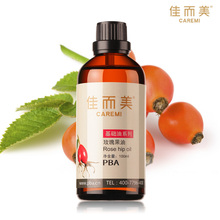 佳而美 玫瑰果油 正品 100ml 美白保湿 去疤痕 祛痘 基础油