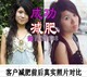 菲克减肥消脂纤维