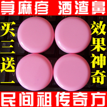 荨麻疹|酒渣鼻|祛癣痘|三盒一疗程90元，买三盒送一盒|一人一方