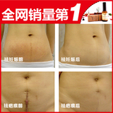 【5折狂欢】阿奴 去妊娠纹精油袪除肥胖纹产后消除去除疤痕修复