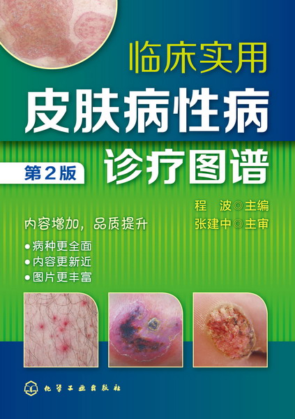 包邮 临牀实用皮肤病性病诊疗图谱 第2版 常见皮肤病治疗书籍 常见
