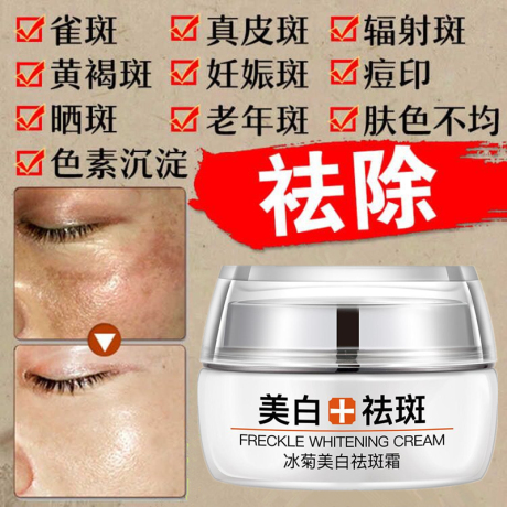 雀斑特效产品