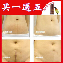 <em>头发修复</em>精油热销爆款|精油<em>修复分叉头发</em>,欧莱