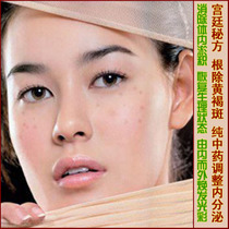 【肝斑祛斑】最新最全肝斑祛斑 产品参考信息