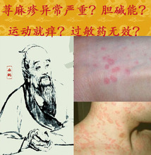 【<em>胆碱能荨麻疹</em>】最新最全<em>胆碱能荨麻疹</em> 产品