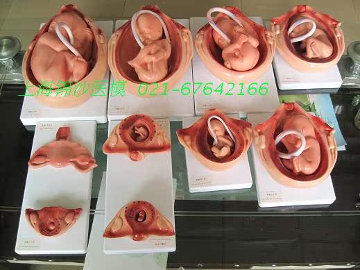 胎儿妊娠发育过程模型/怀孕胎儿模型/妊娠胚胎模型医学模型